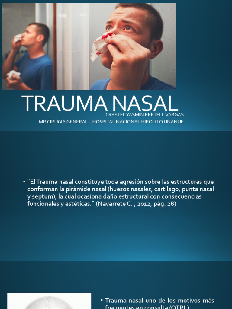Trauma Nasal Rotacion Plastics PDF Lesión Hueso