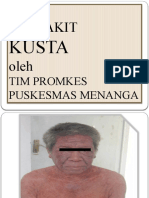 KUSTA