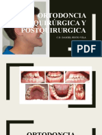 Ortodoncia Pre y Postquirurgica