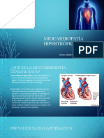 Miocardiopatía Hipertrófica