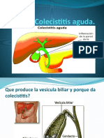 Colecistitis Aguda