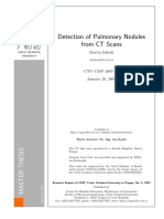 Detection of Pulmonary Nodules From CT Scans: Martin Dolej S I