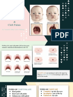 Cleft Palate and Cleft Lip