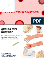 Tipos de Heridas!