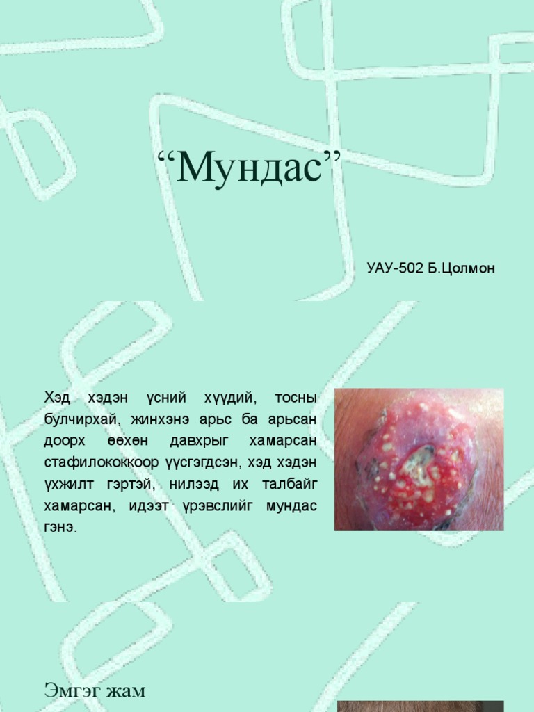 Мундас | PDF