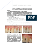 Opción de Manejo Periodontal de Lesiones Cervicales No Cariosas