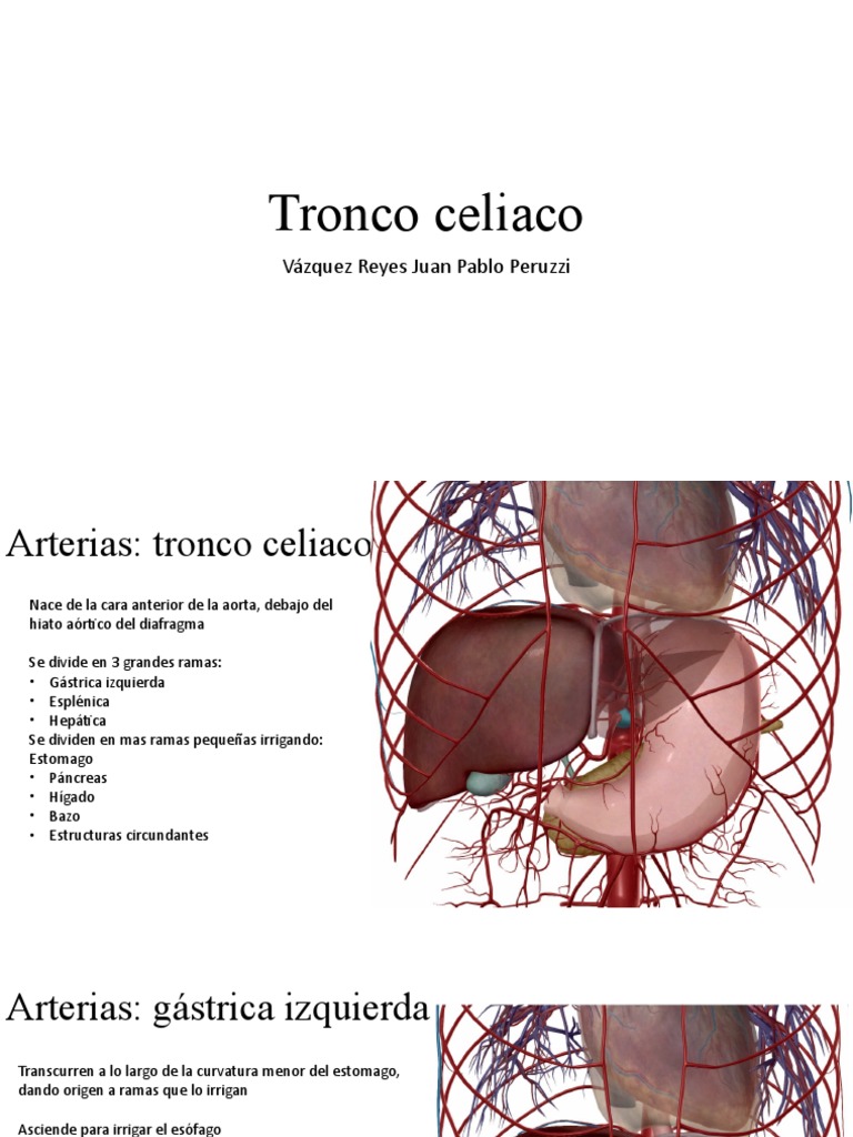 Tronco Celiaco PDF