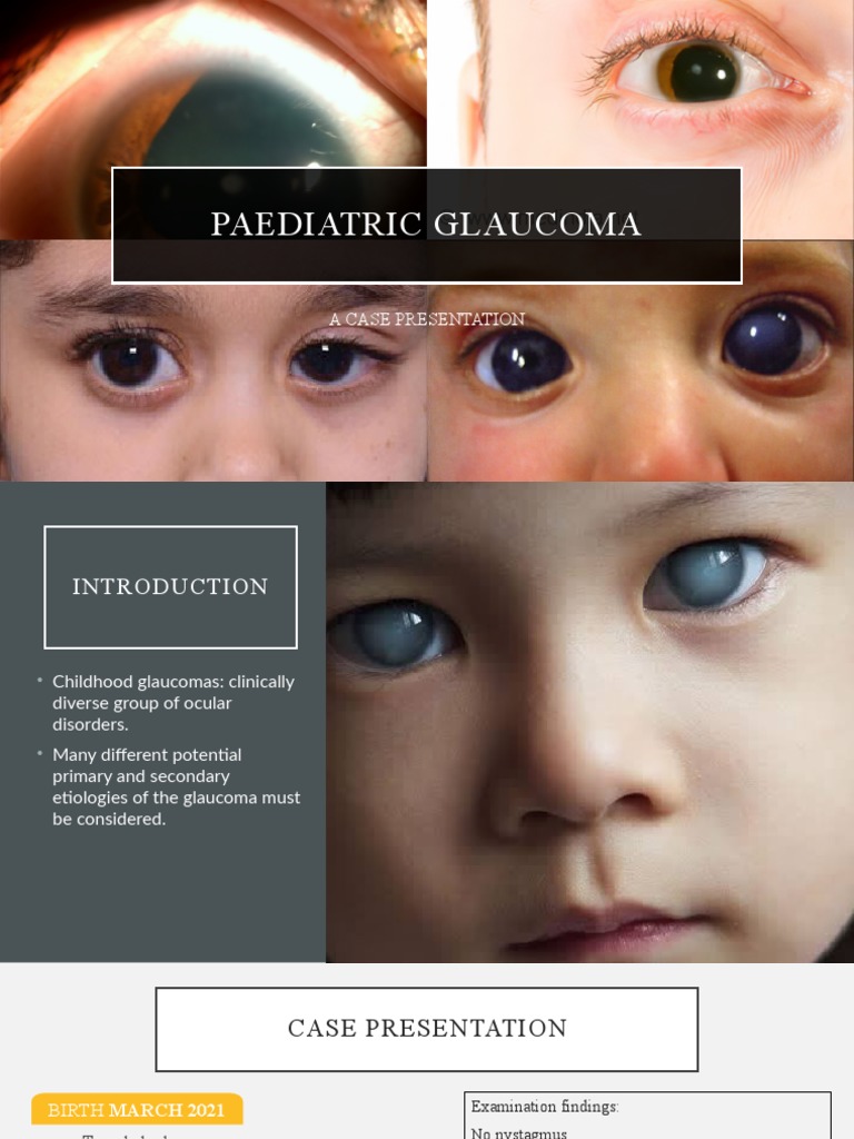 Paediatric Glaucoma | PDF | Glaucoma | Surgery