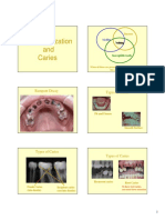 Demineralization and Caries