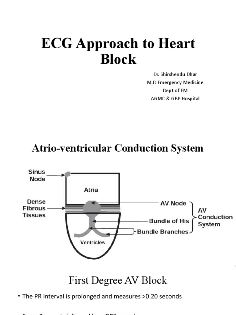 heart-block-pdf-cardiovascular-diseases-cardiac-arrhythmia