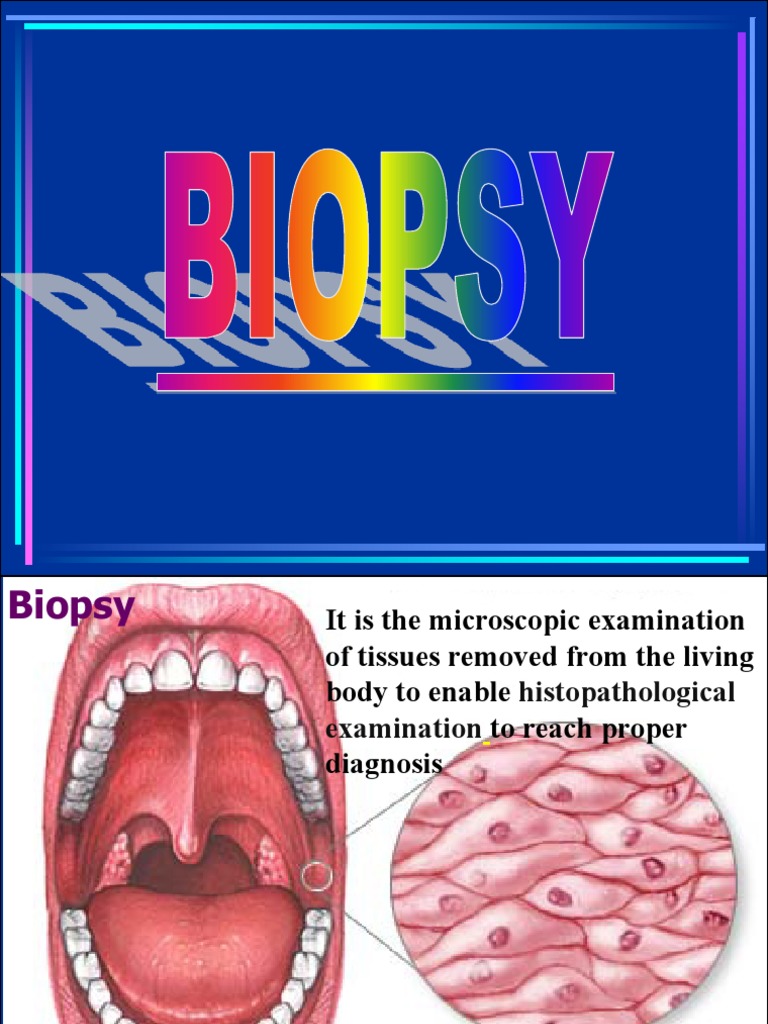 Biopsy PPT, Removable Prosthodontics With Repair Chapter PDF Biopsy