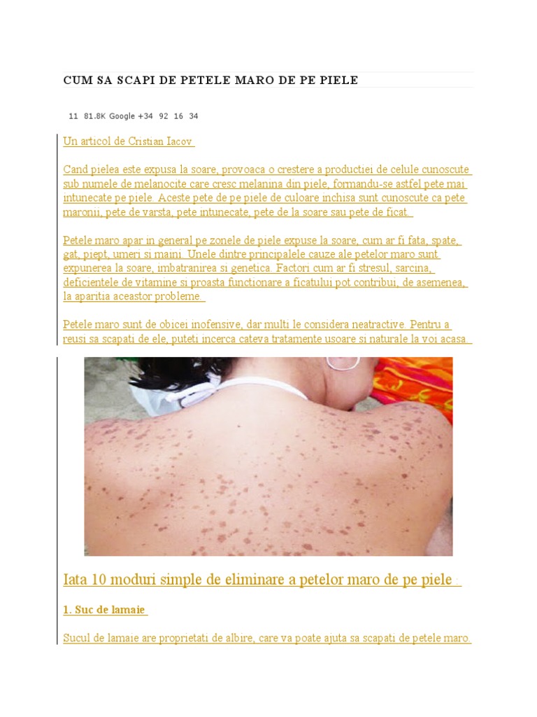 Cum Sa Scapi de Petele Maro de Pe Piele | PDF