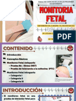 Monitoria Fetal