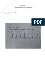 Tugas EKG