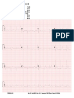 Peila38 394430 Electrocardiograma Anexo 1