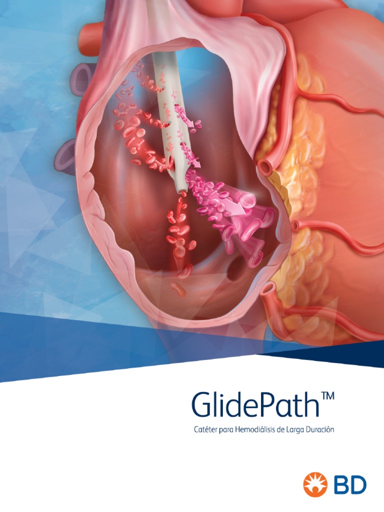 Brochure Glidepath - Uso Externo - Digital | PDF
