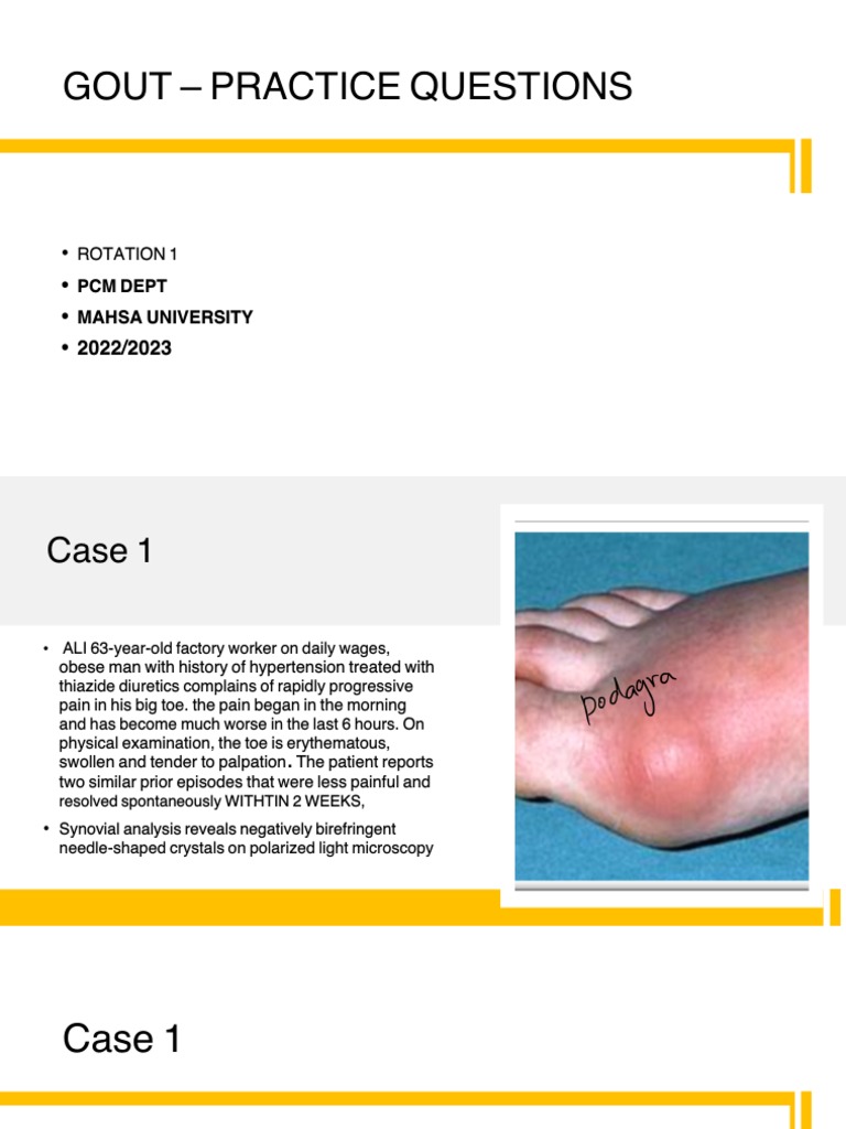 Gout: Visual Explanation For Students – YDFJTK