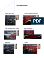 Lower Limb Ultrasound