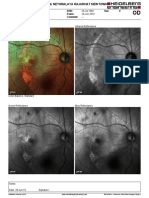 MultiColor - Selective Color Laser Images