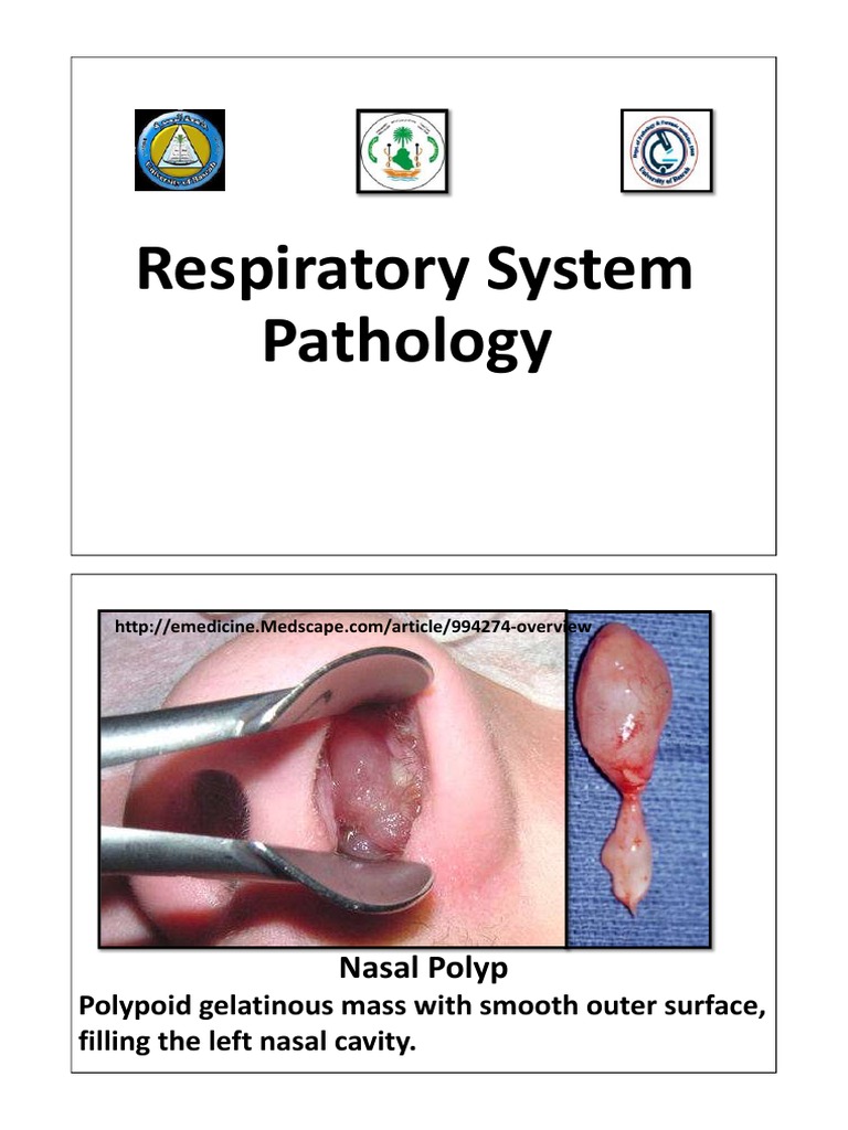 Respiratory System Pathologies Overview | PDF | Lung | Diseases And ...