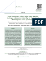 Glosectomía Parcial Con Técnica de Resección en Cuña Estelar