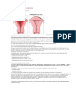 Hiperplazia Endometriala 1