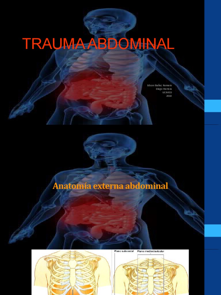 Manejo del Trauma Abdominal | PDF | Abdomen | Lesión