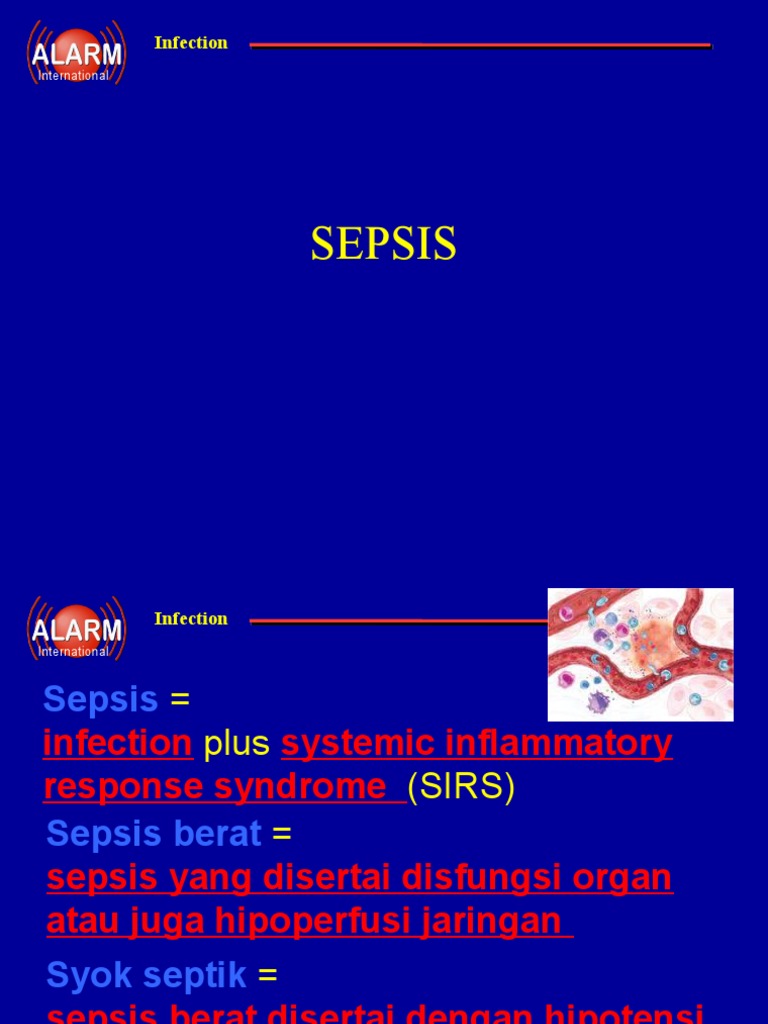 Sepsis Edit Dr. Edwin Armawan, SpOG (K), MM, MHKes, MMRS PDF