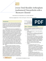 Technique For Reverse Total Shoulder Arthroplasty For Primary Glenohumeral Osteoarthritis With A Biconcave Glenoid