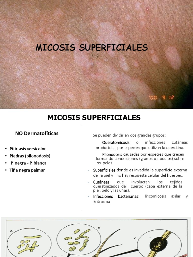 clase-06-micosis-superficiales-pdf-piel