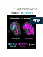 Cerebro Neurotípico Vs Cerebro Neurodiverso