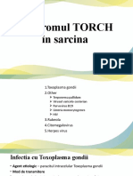 5) SDR TORCH
