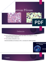 Leucemias Pilosas