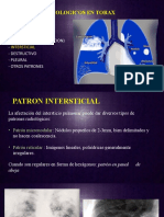 Patron Intersticial