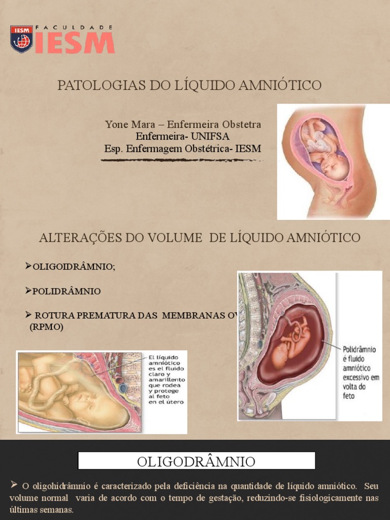 Patologias do Líquido Amniótico | PDF | Gravidez | Parto