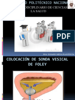 Colocación de Sonda Vesical