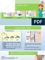 Malformaciones Del Tubo Neural