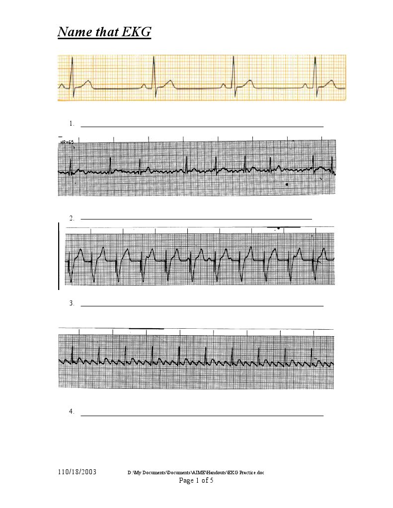 EKG Rhythm Identification Practice | PDF | Science & Mathematics