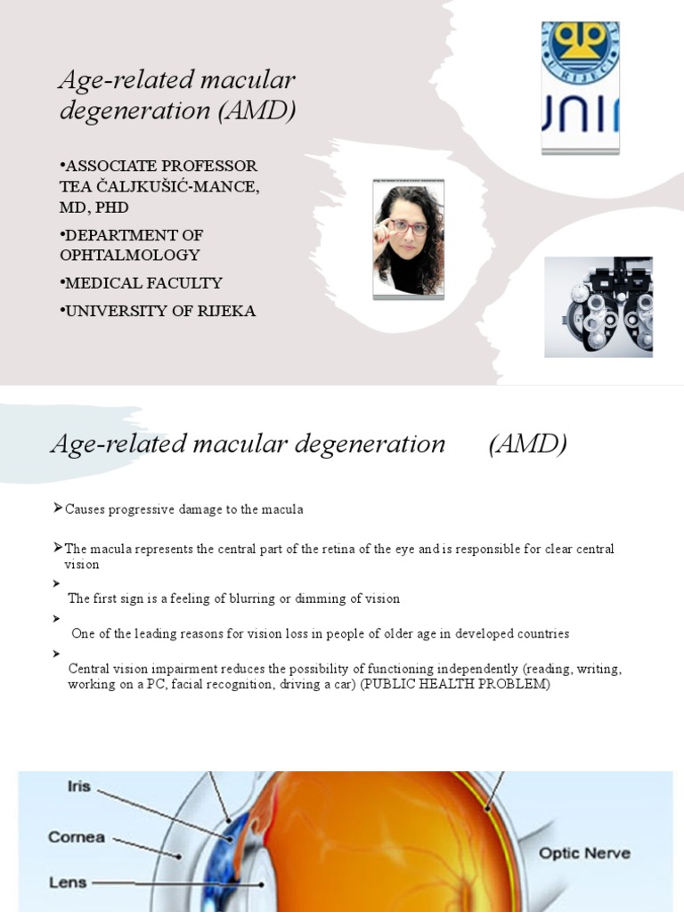 Age-Related Macular Degeneration Guide | PDF | Clinical Medicine ...