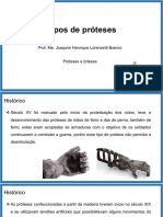 03 - Tipos de Próteses