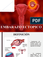 Embarazo Ectópico