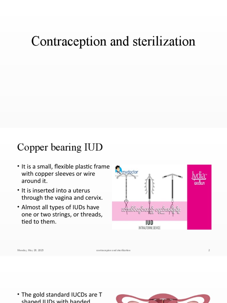 Contraception and Sterilization PDF Birth Control Condom
