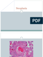 Chapter 4 Neoplasia