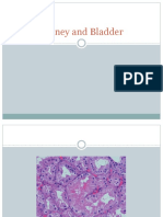 Chapter 16 Kidney and Bladder Pathoma