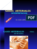 Interpretación de Gases Arteriales - AGA