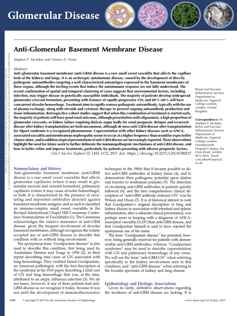 Anti Glomerular Basement Membrane Disease.18 | PDF | Autoimmunity ...