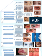 Parapdos, Ojo y Nariz