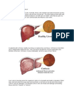 Pa Tho Physiology of Liver Cancer