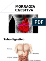 Hda Hemorragia Digestiva