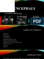 Anencephaly 1 PPTX